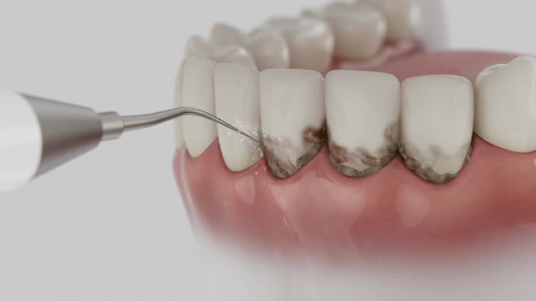 Trusted Invisalign Clear Aligners service in Sumner, IL - Dentist Open Now